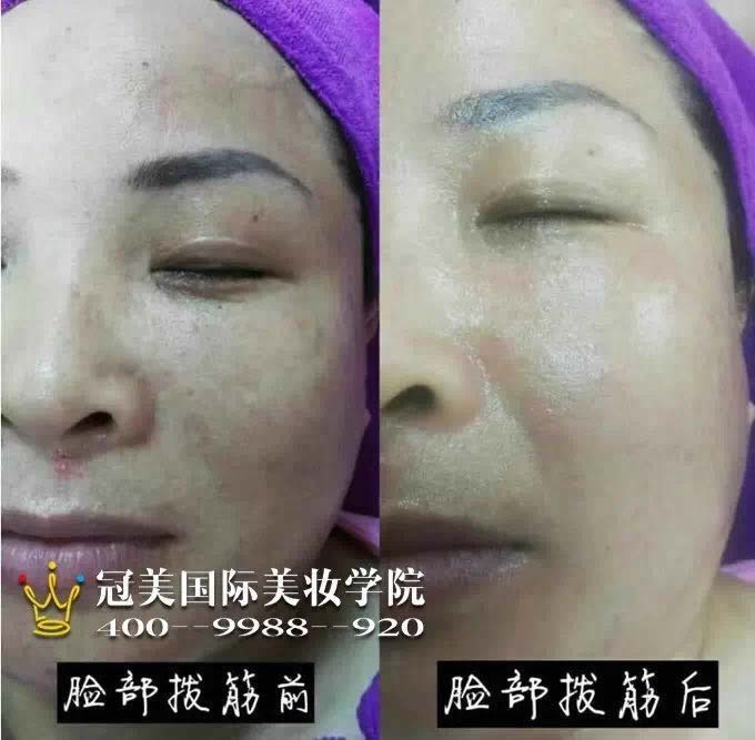 沿ǰԱ